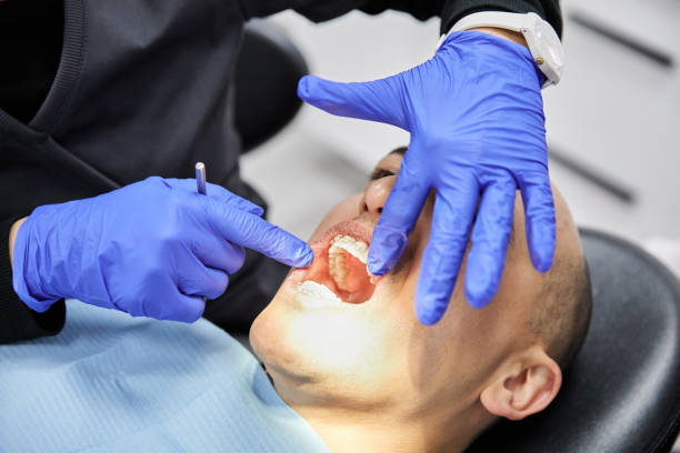 Best Emergency Wisdom Teeth Removal in Union City, MI