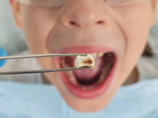 Best Cosmetic Emergency Dentistry in Union City, MI